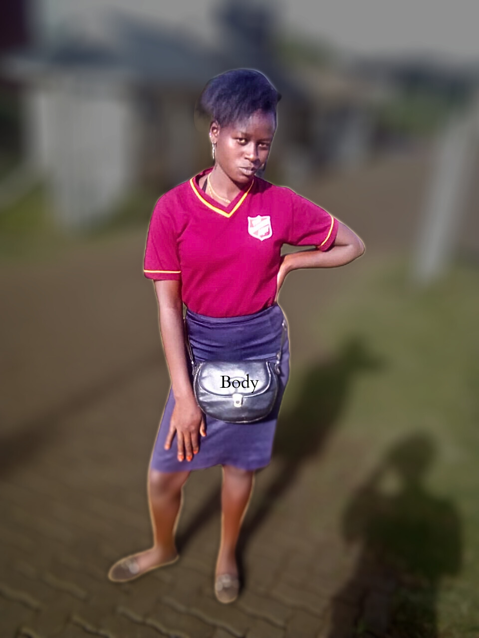 Understanding musculoskeletal tuberculosis (Pott’s Diseases)and Its